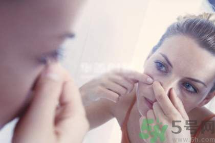 痘痘里面擠出來的白色東西是什么? 痘痘里面擠出來的白色東西是什么?