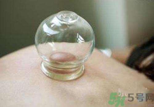 拔火罐和拔氣罐哪個(gè)好？拔火罐和拔氣罐的區(qū)別