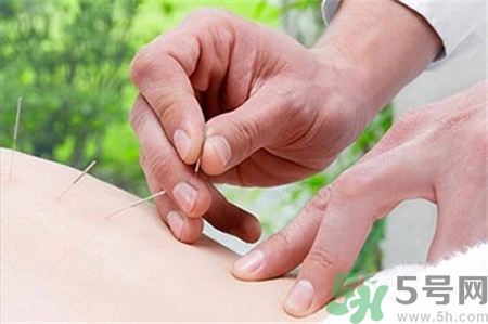 針灸時頭暈胸悶是什么原因?針灸暈針怎么辦? 針灸時頭暈胸悶是什么原因?針灸暈針怎么辦?