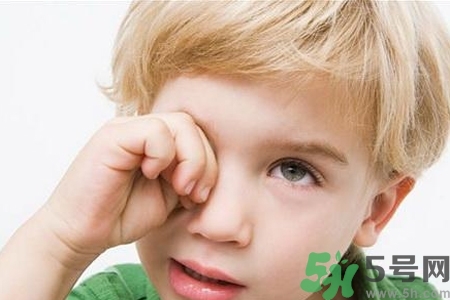 流行性腮腺炎的表現(xiàn)有哪些？?流行性腮腺炎飲食怎么調(diào)理？