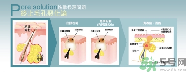 霓凈思Neogence粉刺溶解精華液真假辨別圖 霓凈思Neogence粉刺溶解精華液真假辨別圖