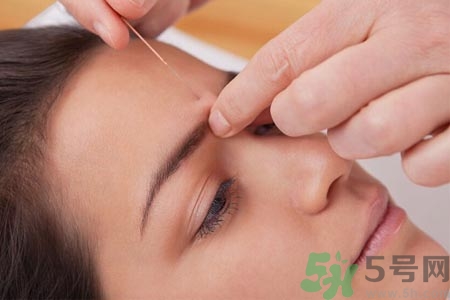 針灸一次要扎多長時間？針灸可以幾天做一次？