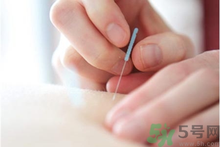 針灸一次要扎多長時間？針灸可以幾天做一次？