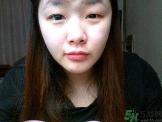 天生腫眼泡怎么消除？天生腫眼泡怎么辦？