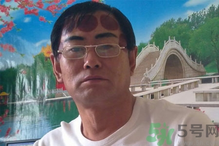 頭痛可以在額頭上拔火罐嗎？額頭上拔火罐有什么好處？