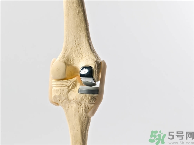 膝關(guān)節(jié)疼痛是怎么回事該怎么辦？膝關(guān)節(jié)疼痛如何治療？