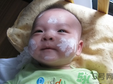 新生兒濕疹可以用爐甘石洗劑嗎？新生兒濕疹的護理措施
