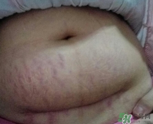 孕婦肚子上的黑線能看出生男生女嗎? 孕婦肚子上的黑線能看出生男生女嗎?