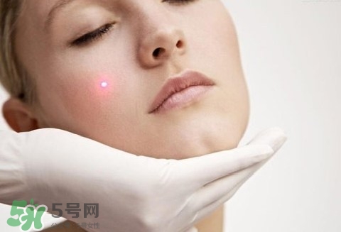 激光祛斑后吃什么才能恢復快點?激光祛斑后吃什么好? 激光祛斑后吃什么才能恢復快點?激光祛斑后吃什么好?