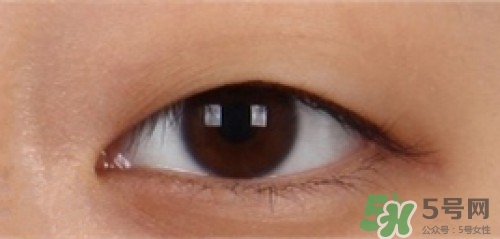 埋線雙眼皮多久恢復(fù)自然？埋線雙眼皮多久能恢復(fù)