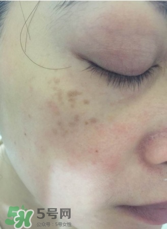 ipsa適合什么年齡 茵芙莎適合什么年齡 ipsa適合什么年齡 茵芙莎適合什么年齡