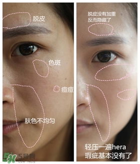 赫拉氣墊用了悶痘嗎？赫拉氣墊悶痘怎么辦？