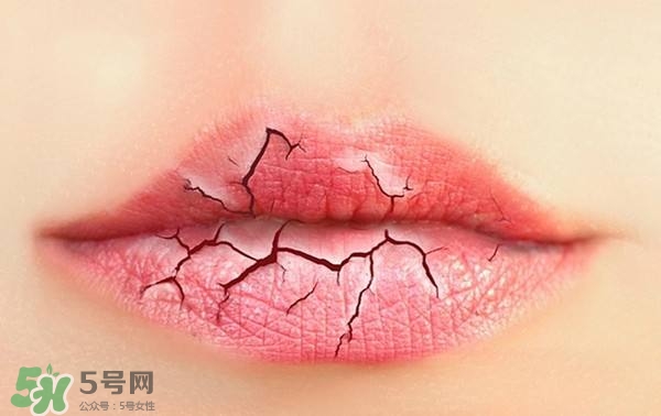 唇紋怎么去 唇紋深怎么辦 唇紋怎么去 唇紋深怎么辦