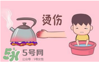 燙傷可以用牙膏嗎？燙傷用牙膏管用嗎？