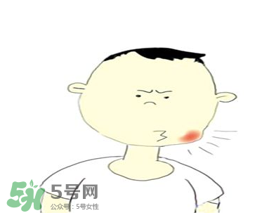 嘴角起泡是什么原因？嘴角起泡怎么辦？