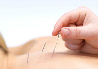 針灸可以治療風濕嗎？針灸治風濕性關節(jié)炎效果好嗎？