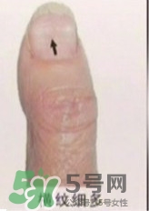 男子指甲35年不剪 指甲與健康的關(guān)系 男子指甲35年不剪 指甲與健康的關(guān)系