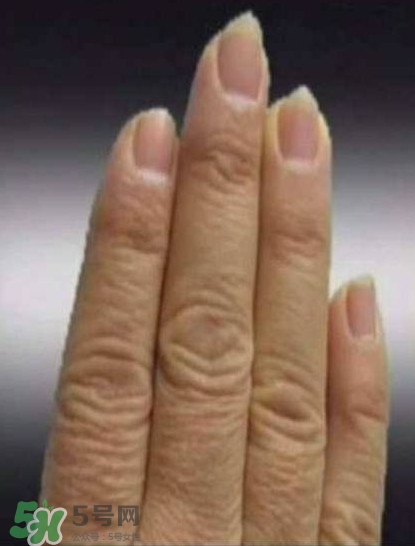 男子指甲35年不剪 指甲與健康的關(guān)系 男子指甲35年不剪 指甲與健康的關(guān)系