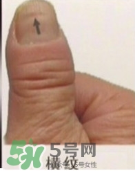 男子指甲35年不剪 指甲與健康的關(guān)系 男子指甲35年不剪 指甲與健康的關(guān)系
