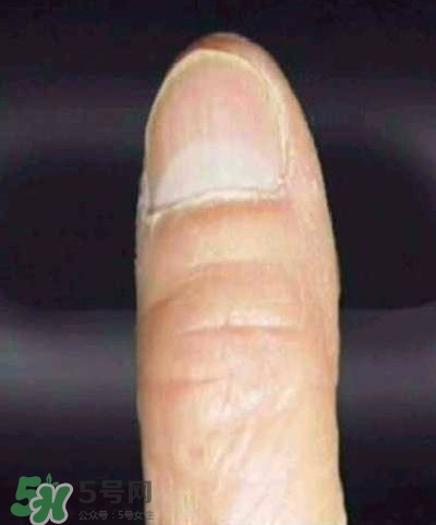 男子指甲35年不剪 指甲與健康的關(guān)系 男子指甲35年不剪 指甲與健康的關(guān)系