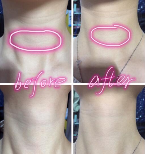 天鵝頸是什么樣的？天鵝頸怎么練？