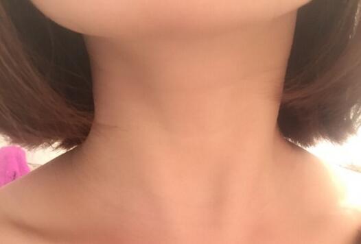 天鵝頸是什么樣的？天鵝頸怎么練？