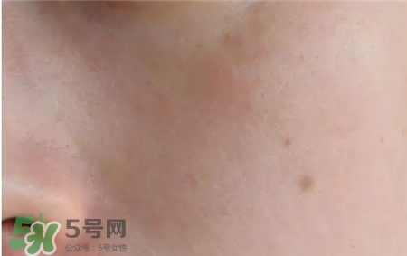 martiderm安瓶精華好用嗎?martiderm安瓶怎么樣? martiderm安瓶精華好用嗎?martiderm安瓶怎么樣?