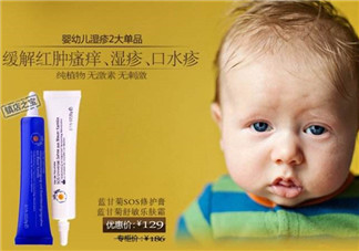 恩姆花園濕疹膏有激素嗎？恩姆花園濕疹膏含不含激素？