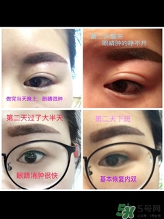 半永久霧眉圖片 半永久霧眉結(jié)痂時(shí)圖片 半永久霧眉圖片 半永久霧眉結(jié)痂時(shí)圖片