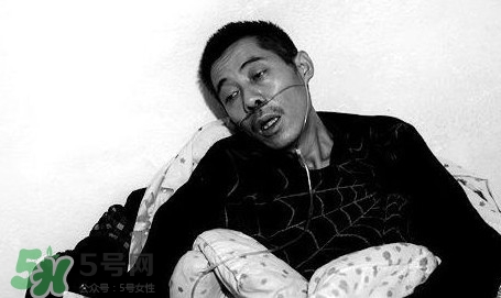 塵肺病吃什么藥能清肺？塵肺病國家有什么政策