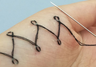 人體刺繡是自殘嗎？人體刺繡有什么危害