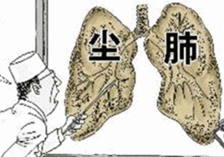 塵肺病能治愈嗎？塵肺病能活多久