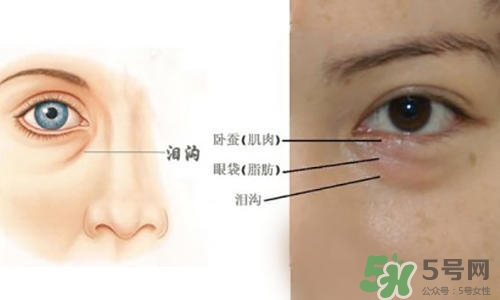 淚溝能自己恢復(fù)嗎？淚溝怎么自己恢復(fù)？