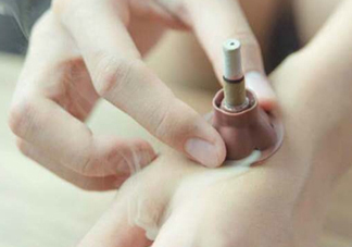 艾艾貼貼后出現(xiàn)水泡怎么回事？艾艾貼后有水泡怎么辦？