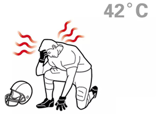 熱射病為什么不能喝水？熱射病為什么會(huì)抽搐