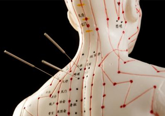 針灸可以自己扎嗎？針灸可以減肥嗎