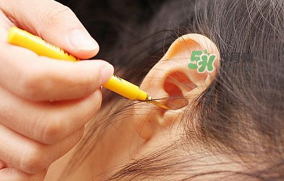 兒童耳屎成硬塊怎么辦？?jī)和撼捎矇K有危害嗎？