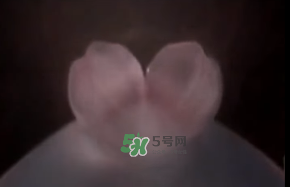 懷孕初期怎么保胎？陰道出血是流產(chǎn)征兆嗎？