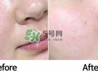 homefacialpro蜂膠面膜怎么樣_hfp蜂膠面膜好用嗎 homefacialpro蜂膠面膜怎么樣_hfp蜂膠面膜好用嗎