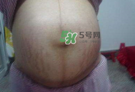 懷女孩肚子上會(huì)長(zhǎng)毛嗎？懷女孩肚子特征圖片