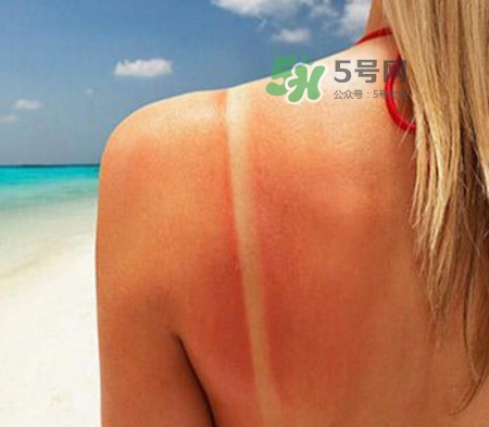 曬后如何修復(fù) 曬后修復(fù)成分有哪些 曬后如何修復(fù) 曬后修復(fù)成分有哪些