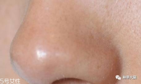 小氣泡是什么 小氣泡去黑頭有效嗎 小氣泡是什么 小氣泡去黑頭有效嗎