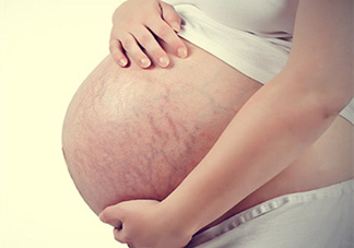 孕婦胸部長妊娠紋嗎？胸部長妊娠紋了怎么辦？