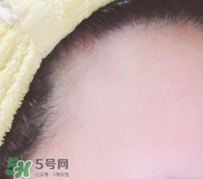 發(fā)際線粉哪個(gè)牌子好？