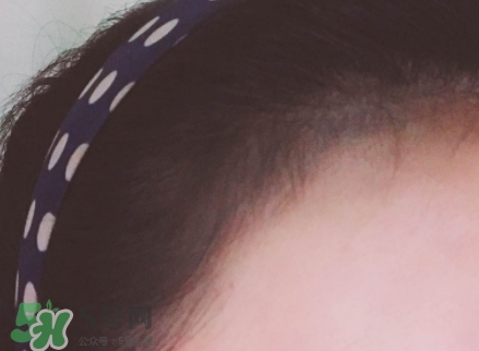 發(fā)際線粉哪個(gè)牌子好？