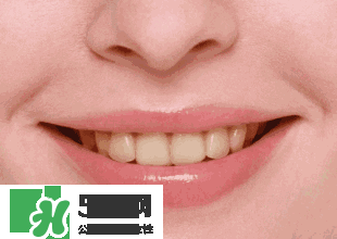 牙齒美白的方法有那些 牙齒美白心得 牙齒美白的方法有那些 牙齒美白心得