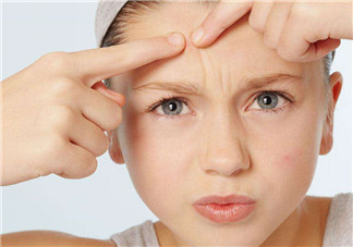 暗瘡可以擠壓嗎？油性和骯臟肌膚會容易有暗瘡嗎？