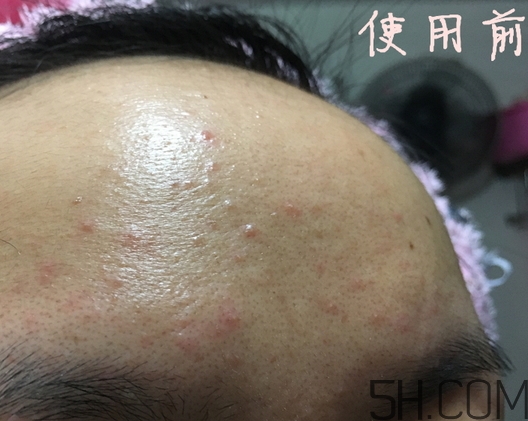 nyr金盞花膏怎么樣_nyr金盞花膏好用嗎 nyr金盞花膏怎么樣_nyr金盞花膏好用嗎