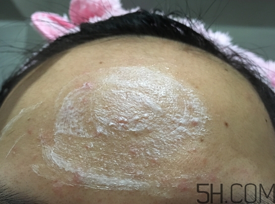 nyr金盞花膏怎么樣_nyr金盞花膏好用嗎 nyr金盞花膏怎么樣_nyr金盞花膏好用嗎