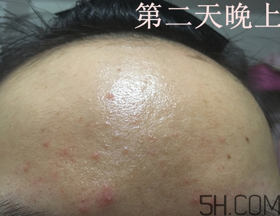 nyr金盞花膏怎么樣_nyr金盞花膏好用嗎 nyr金盞花膏怎么樣_nyr金盞花膏好用嗎